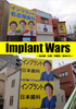 Implant Wars