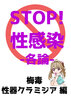 STOP!性感染-各論-梅毒・性器クラミジア編