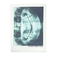 wisdom teeth diary(親知らず日記)